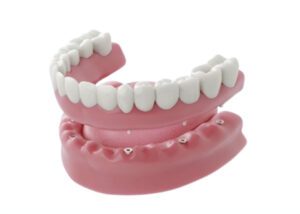 Dentures in Cudahy, WI